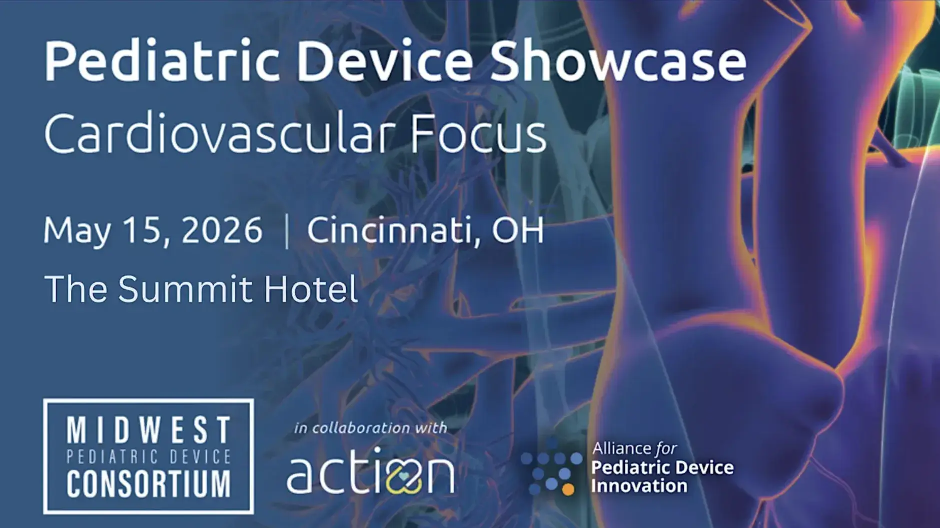 This image is the flyer for thr Pediatric Device Showcase, Cardiovascular Focus 